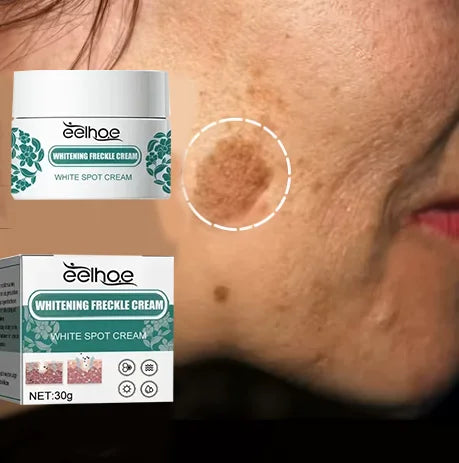 Niacinamide Brightening Melasma Cream