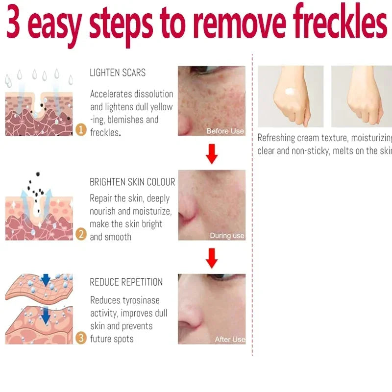 Niacinamide Brightening Melasma Cream